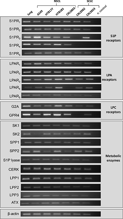 Expression of receptors and enzymes involved in BphsL signaling and synthesis.