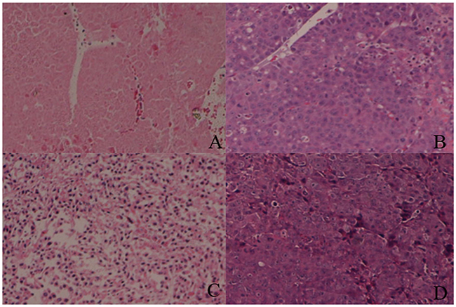 Hematoxylin&#x2013;eosin (H&#x0026;E) staining for tumor tissues.