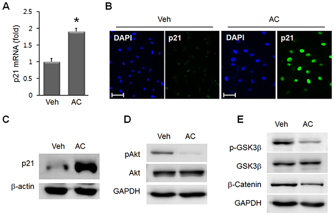 Effects of apicidin on p21, Akt, and GSK3&#x03B2;/&#x03B2;-catenin in MSC.