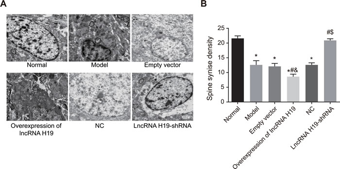 Ultrastructures of hippocampal CA1 region of rats in each group were observed by an electron microscope (&times;400).