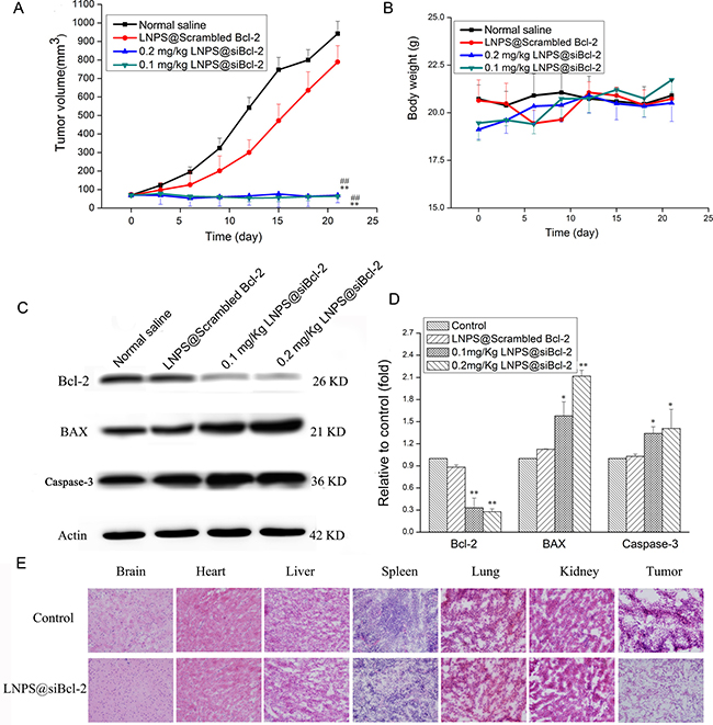 The in vivo antitumor activity of LNPS@siBcl-2 on tumor-bearing nude mice.