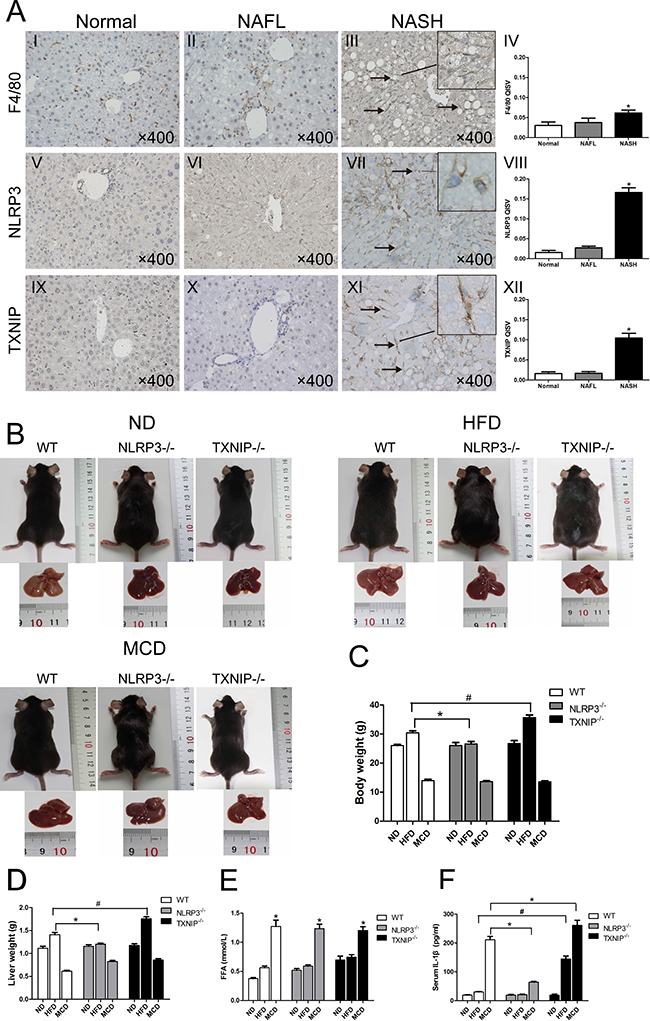 KCs infiltration and expressions of NLRP3 and TXNIP are elevated in NASH livers of WT mice.
