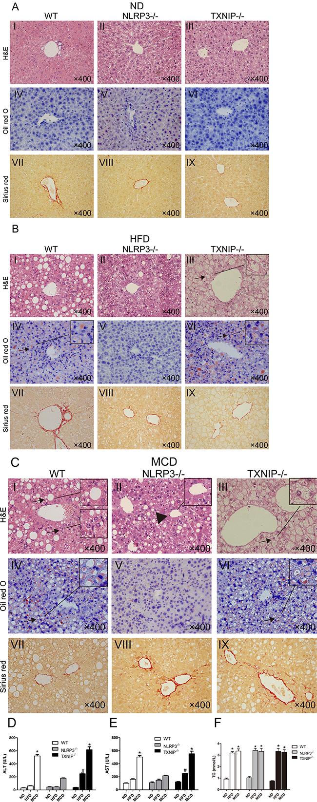 NLRP3&#x2212;/&#x2212; mice exhibit reduced hepatocyte injury in MCD group and TXNIP knockout results in exacerbated hepatocyte injury after HFD feeding.