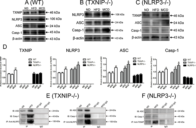 NLRP3 inflammasome activation in KCs promotes NAFL to NASH progression.