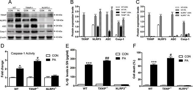 TXNIP inhibits NLRP3 inflammasome activation and IL-1&#x03B2; secretion in vitro.