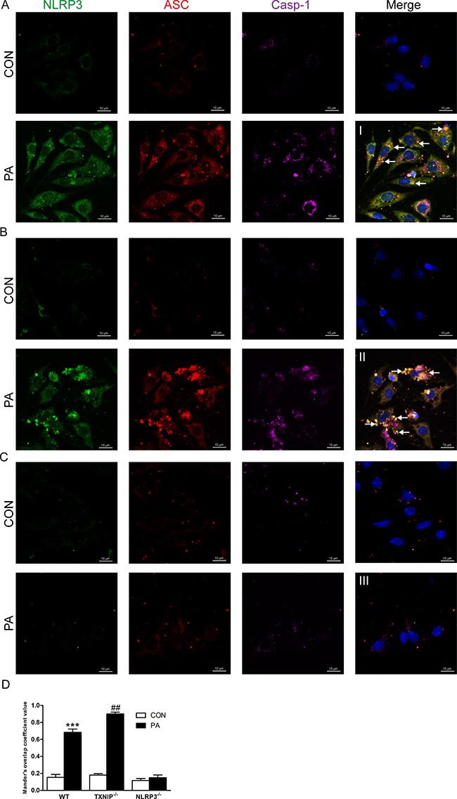 TXNIP deficiency enhances the co-localization of NLRP3, ASC and Caspase-1 in KCs.