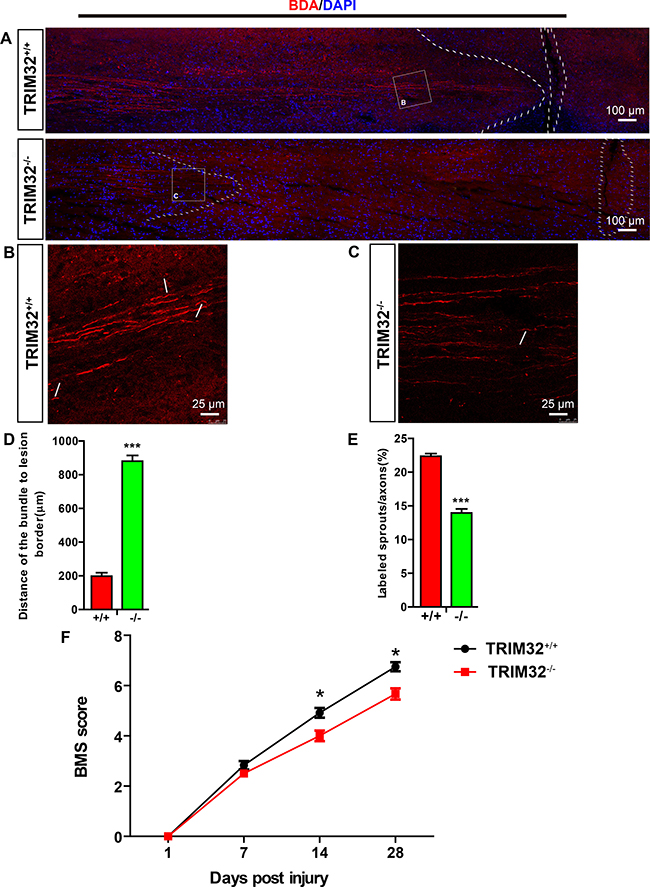 TRIM32&#x2013;/&#x2013; mice exhibited impaired axonal regeneration and behavioral recovery following spinal cord injury.