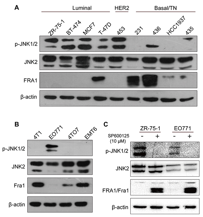 Fra1 level inversely correlated with the phosphorylation status of JNK in different types of breast cancer cell lines.
