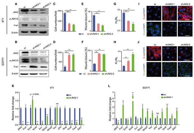 Down-regulation of JNK2 had different effects on cell migration in mouse breast cancer cells.
