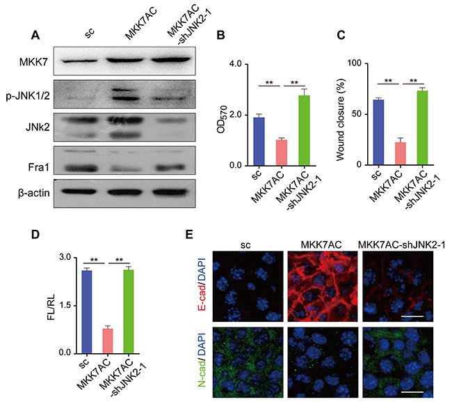 Overexpression of MKK7AC to promote the phosphorylation of JNK2 inhibited the metastasis of 4T1 cells.