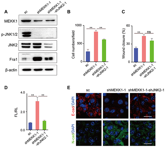 Silencing of MEKK1 to inhibit the phosphorylation of JNK2 promoted the metastasis of EO771 cells.