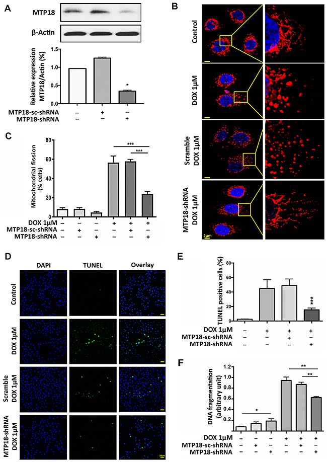 Knockdown of MTP18 interferes doxorubicin-induced mitochondrial fission and apoptosis.