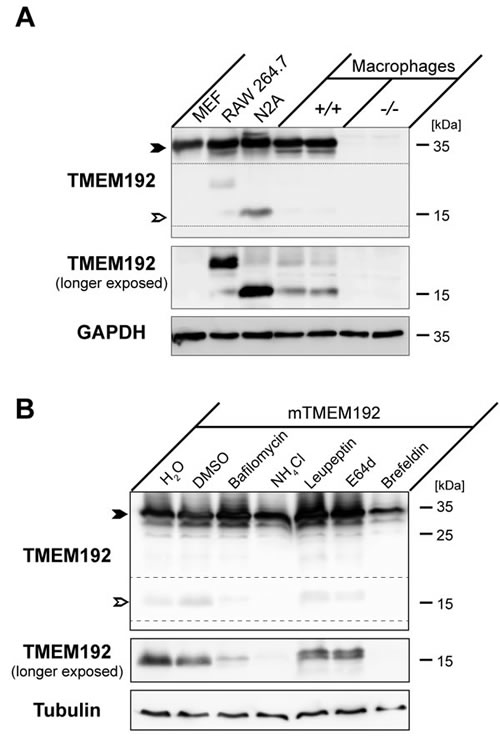Proteolytic processing of murine TMEM192 occurs in lysosomes.