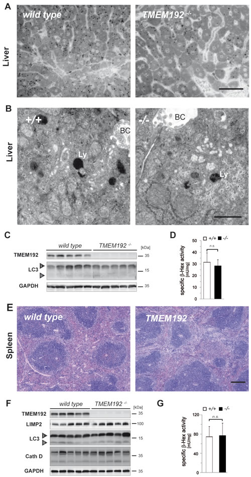 Regular liver and spleen architecture without signs of lysosomal dysfunction in TMEM192-deficient mice.