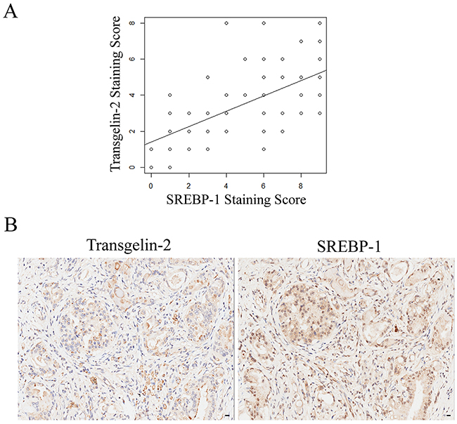Correlation between transgelin-2 and SREBP-1.