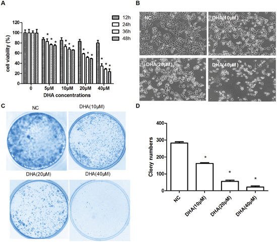 The inhibition of Cal-27 cells proliferation in vitro by DHA.