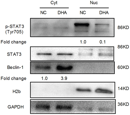 The analysis of STAT3 nuclear translocation via Western blot in Cal-27 cells.