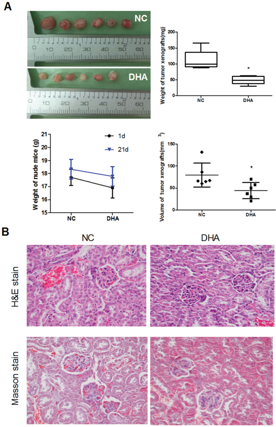 The anti-tumor effect of DHA on Cal-27 cell xenograft tumor in mice.