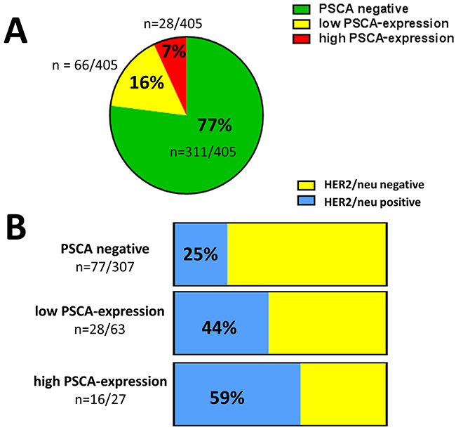 PSCA-expression in breast cancer and its association with HER2/neu status.