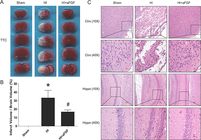 aFGF reduces infarct volumes and improves morphological recovery.