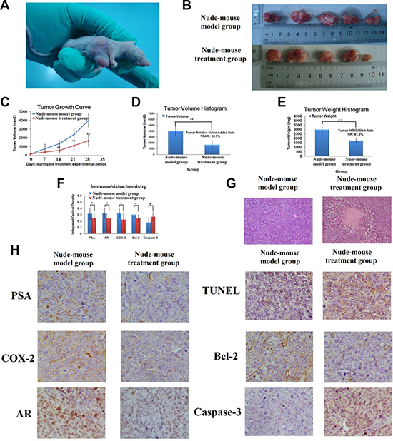 Berberine suppressed 22RV1 prostate cancer cell xenograft growth.