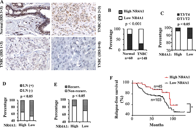 NR4A1 protein in human TNBC and its association with clinicopathological characteristics and disease recurrence.