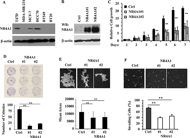 NR4A1 expression inhibits the growth, viability, migration and invasion of MDA-MB-231 cells.
