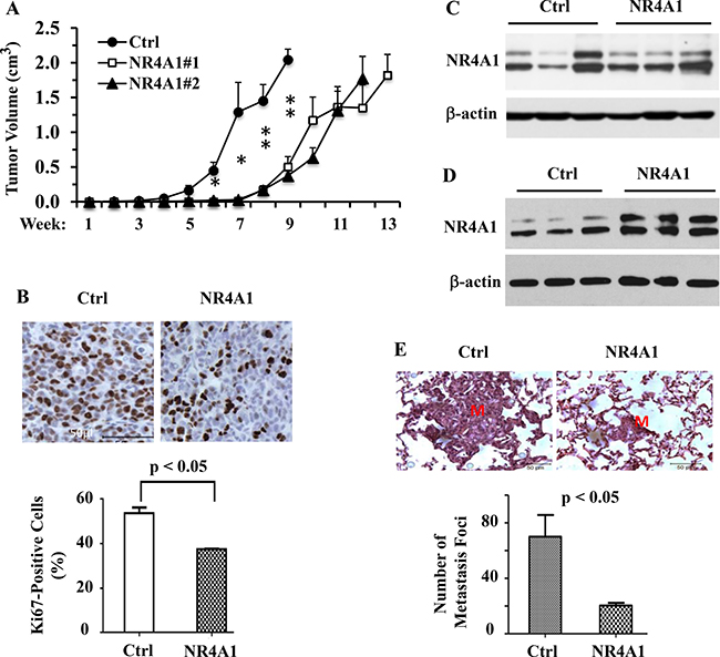 NR4A1 expression inhibits tumor growth and suppresses lung metastasis in SCID mice.
