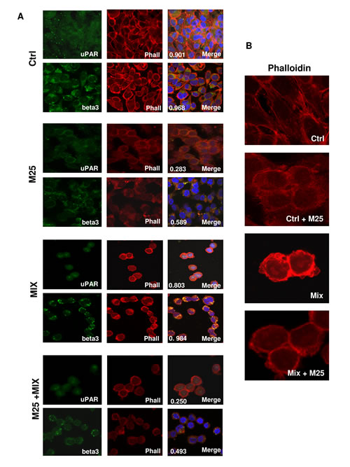 uPAR-actin co-localization.