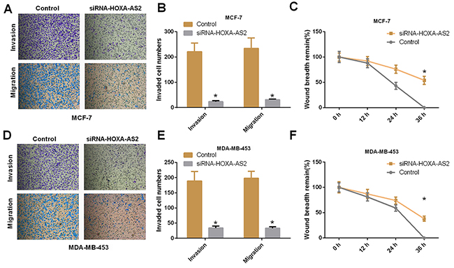 Silencing of HOXA-AS2 expression inhibits migration and invasion of breast cancer cells.