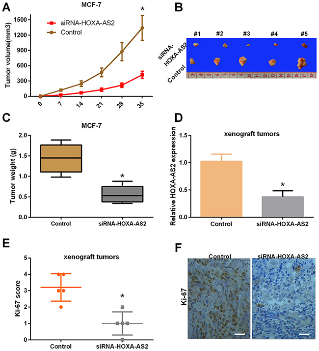 Silencing of HOXA-AS2 expression suppresses tumor growth and inhibits Ki-67 expression in vivo.