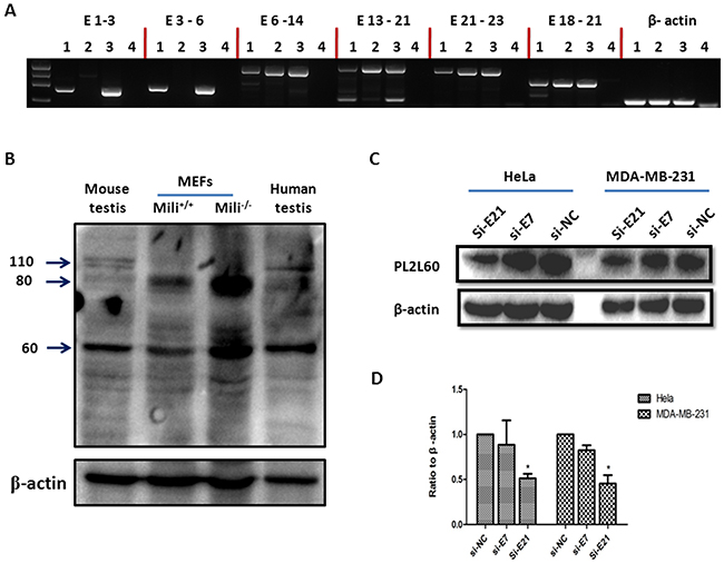 Aberrant activation of PIWIL2 gene by intragenic promoters independently of the integrity of host gene.