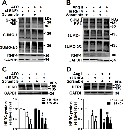 Effect of promotion of PML SUMOylation by RNF4 knockdown on HERG expression.