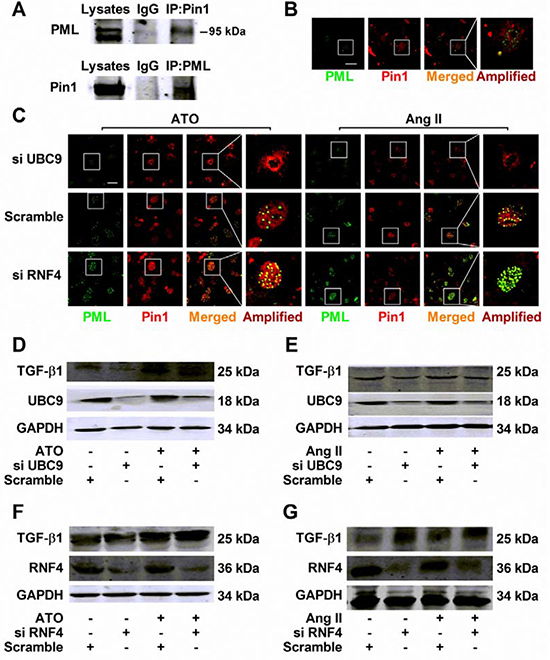 Regulation of TGF-&#x03B2;1 by recruiting Pin1 into PML-NBs during HERG protein degradation.