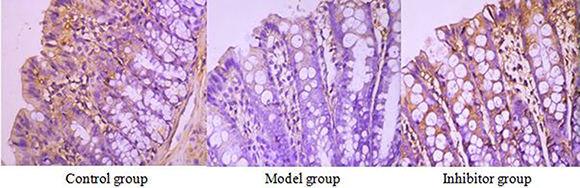The expression of AQP1 in the colon by immunohistochemical technique (*400) AQP1 positive reaction material presents brown, the cell membrane and cytoplasm were dyed.