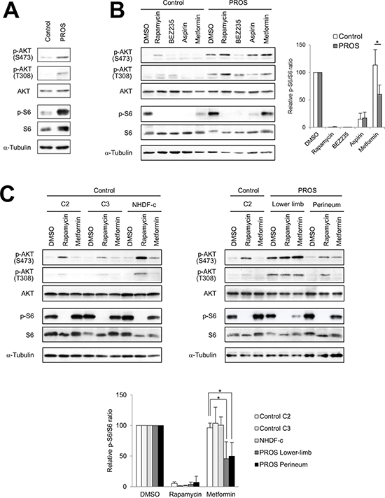Effect of inhibitors of PI3K/AKT/mTOR signaling in fibroblasts.