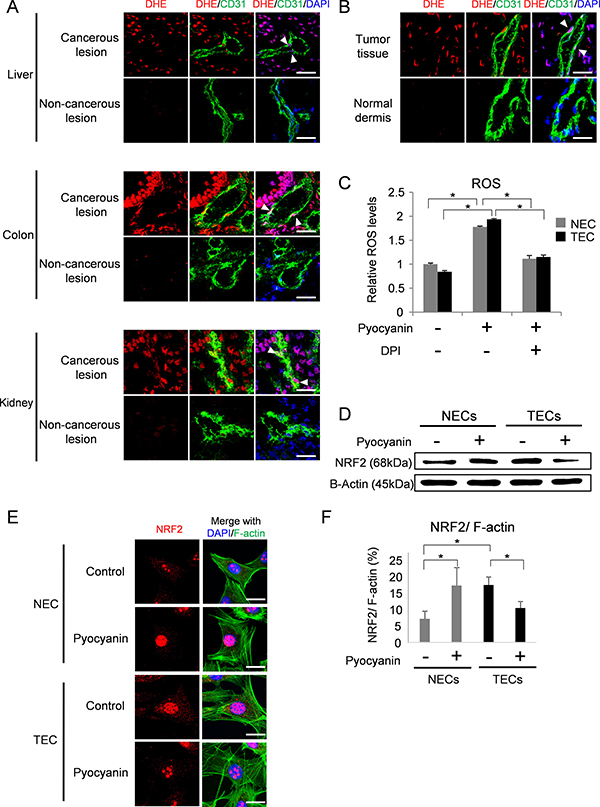 NRF2 response to ROS accumulation in endothelial cells.