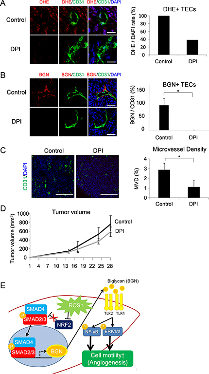 Anti-angiogenic effect by ROS inhibition via downregulation of BGN.