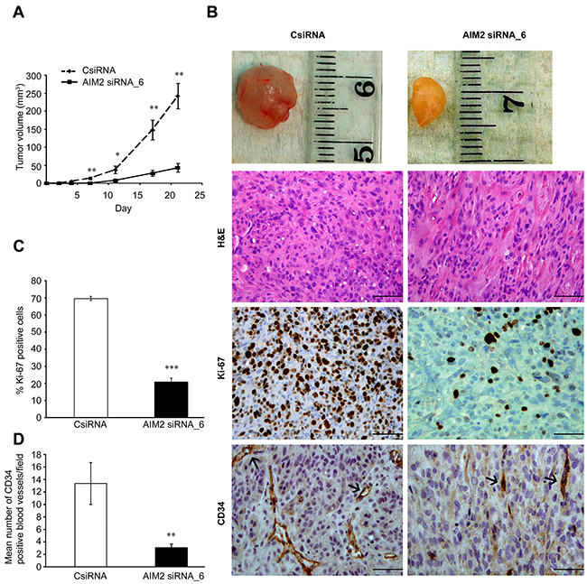 AIM2 knockdown suppresses growth and vascularization of human cSCC xenografts.