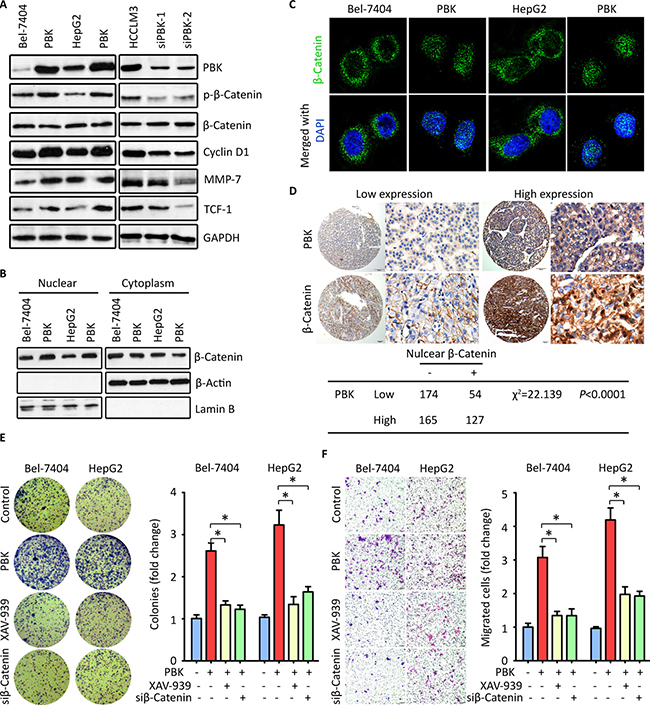 PBK exerts oncogenic activities by activating &#x03B2;-Catenin signaling pathway.