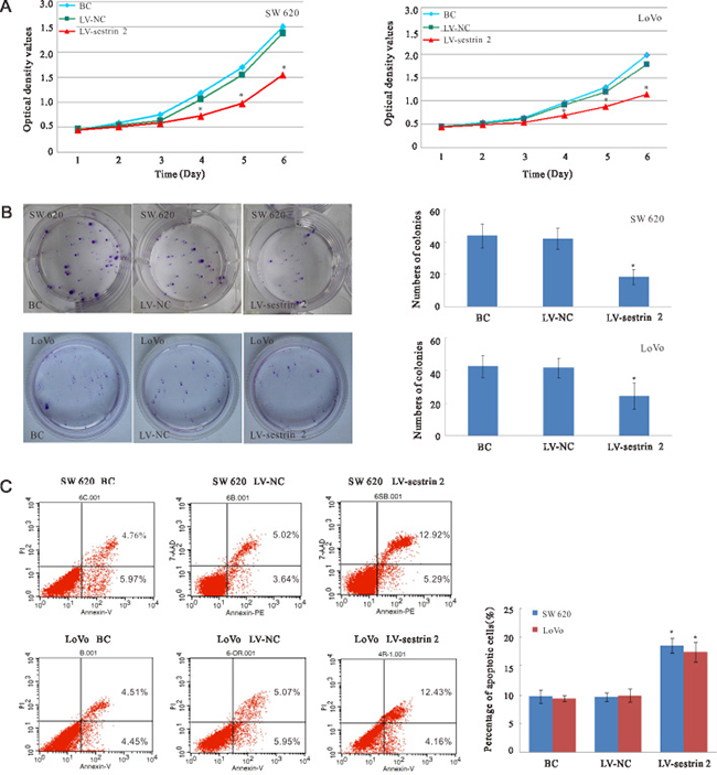 Effects of sestrin 2 overexpression on cell proliferation and apoptosis in CRC cells.