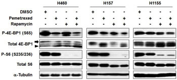 The combination of rapamycin and pemetrexed inhibits the mTOR pathway to a greater extent than either drug alone in a panel of NSCLC cell lines.