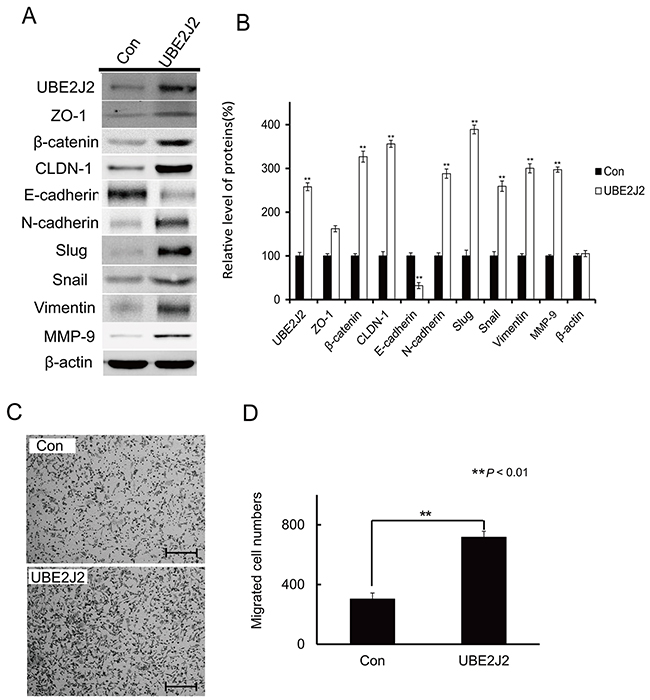 Effects of UBE2J2 overexpression on SMMC7721 cell EMT and invasion.
