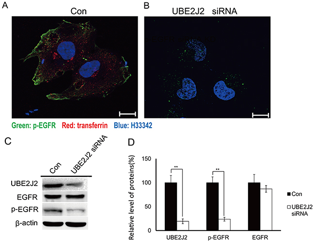 p-EGFR expression in UBE2J2-silenced HCCLM3 cells.