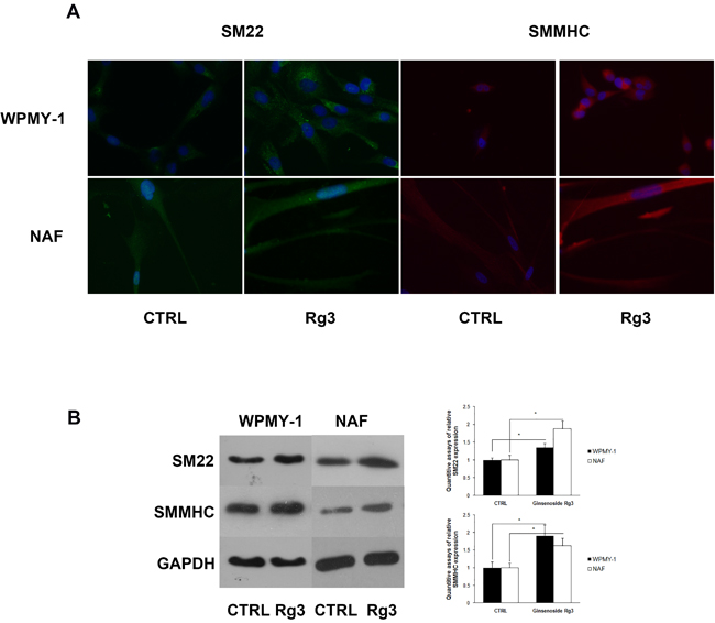 Ginsenoside Rg3 increased SM22 and SMMHC expression in WPMY-1 and NAF cells.