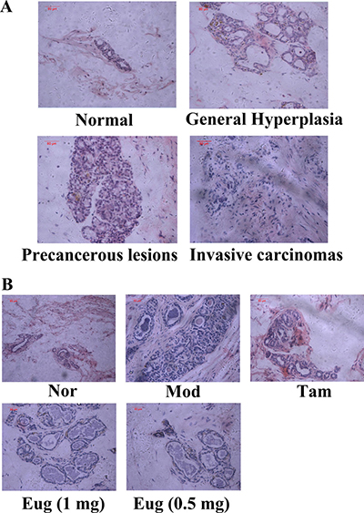Breast tissue morphological assay for rats and eugenol (Eug) decreased the occurrence of breast precancerous lesions and invasive carcinomas in breast precancerous lesion model rats.