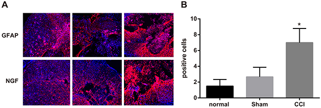 Expressions of glial fibrillary acidic protein (GFAP) and nerve growth factor (NGF) detected by immunofluorescence assay among the control, sham and chronic constriction injury (CCI) groups.