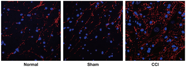 Observation of sympathetic sprouting-produced basket-like structure in dorsal root ganglion (DRG) of rats by tyrosine hydroxylase (TH) immunofluorescence staining among the control, sham and chronic constriction injury (CCI) groups.