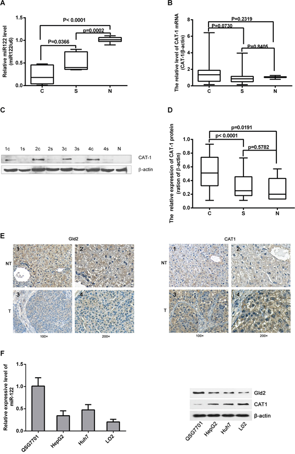 Expression of miR-122, Gld2, and CAT-1 in HCC tissues and hepatic cell lines.