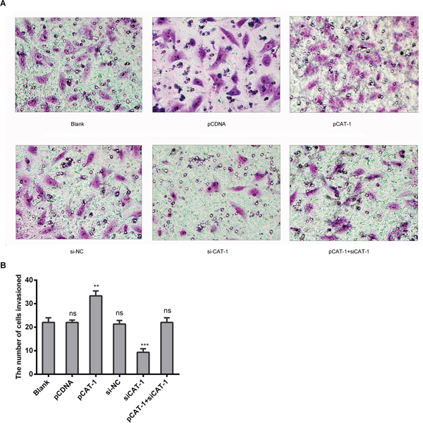 CAT-1 increases HCC cell invasive ability.